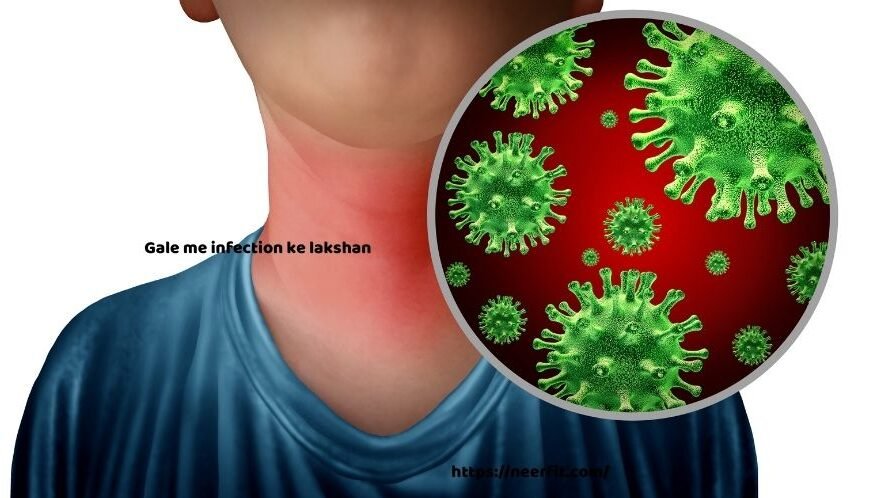 Gale me infection ke lakshan – गले में संक्रमण के लक्षण, कारण, घरेलू उपचार और परहेज